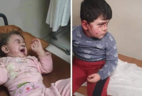  Armenischer Terror gegen aserbaidschanische Kinder  - FOTOS  