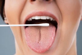   Coronaviren befallen Zellen im Mund  