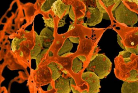 Bald schlimmer als Krebs: Superbakterien – eine Gefahr für die Menschheit