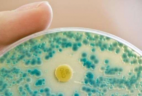 Antibiotika-resistente Keime in deutschen Gewässern: Experten besorgt