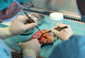 Wird bald jeder automatisch Organspender?