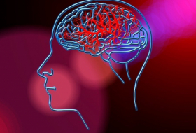 Forscher beweisen: Alzheimer ist ansteckend