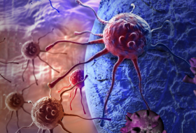 Forscher nennen wirksame Behandlung eines der gefährlichsten Krebstypen