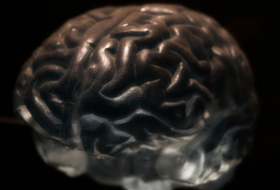   Gibt es Mittel gegen Gehirnalterung?  