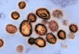 Studie: Coronavirus-Patienten kontaminieren Schlaf- und Waschräume beträchtlich
