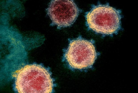   Coronavirus nicht gefährlicher als Grippe?  