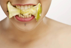  So ist Ernährung gut für die Zähne  