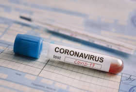   710 Menschen haben sich am vergangenen Tag in Aserbaidschan mit COVID-19 infiziert  