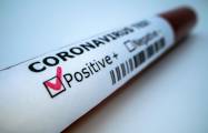   Am letzten Tag wurden in Aserbaidschan 62 Menschen mit dem Coronavirus infiziert  
