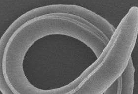   Würmer nach 46.000 Jahren zum Leben erwacht  