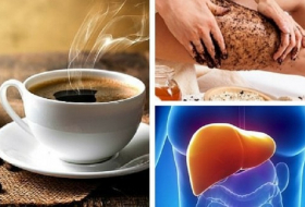7 erstaunliche Gründe warum Kaffee gesund ist