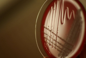 Antibiotika-Resistente Bakterien breiten sich aus–Droht der Menschheit eine Seuche?  
