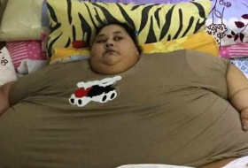 500-Kilo-Frau speckt 250 Kilo ab