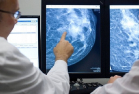 Sind Brustkrebspatientinnen bald von der Chemo erlöst?