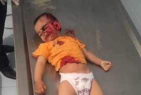 Beweis für armenische Gräueltat - Fotos des getöteten 2-jährigen Mädchens (+18 Fotos)