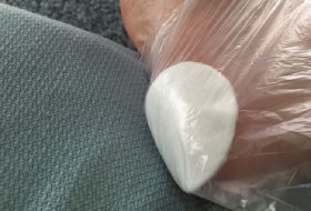 Mega-DIY-Tipp gegen Hornhaut: Wattepad mit Aspirin und Zitronensaft