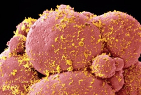 Erbgut-Forschung: Großbritannien erlaubt Genmanipulation von Embryonen